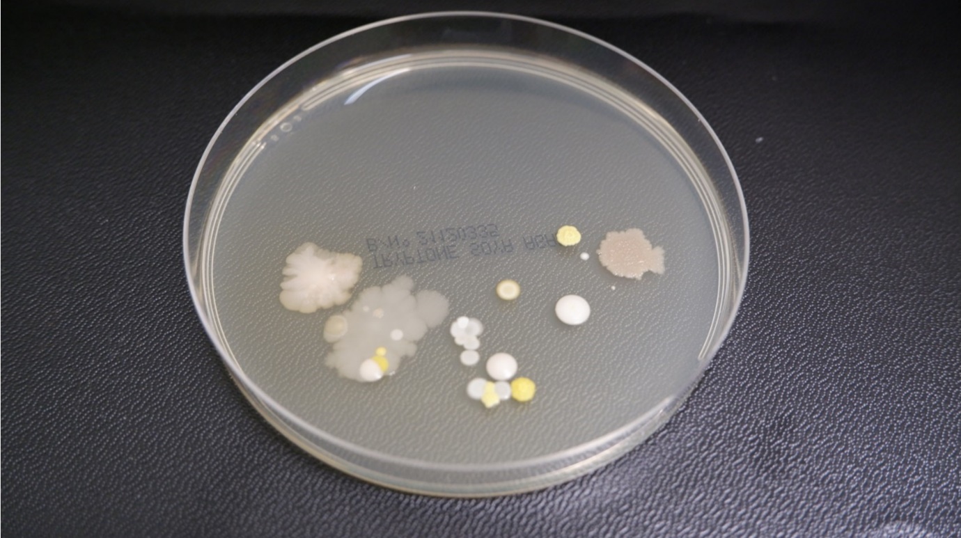 Figure 4 - Incubating plates - irreg clustered growth